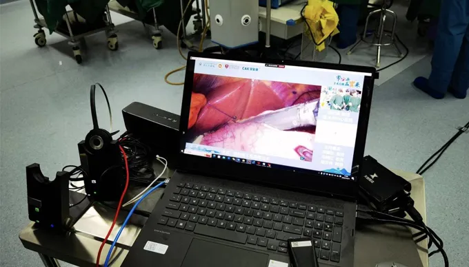 CAK хирургические степлеры блеск в шести живых операций по всему Китаю